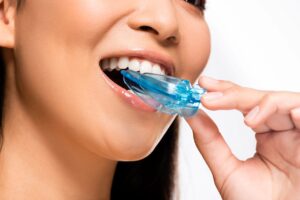 Nose to chin view of woman inserting oral appliance